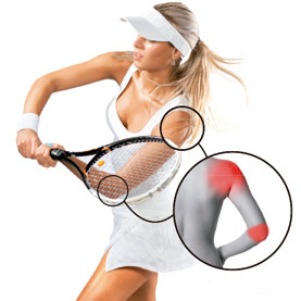 Lesões comuns na prática de tênis